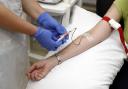 Is there a two-tier service for blood tests between Suffolk and Essex?